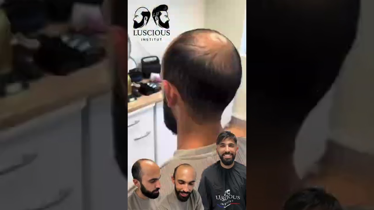 Transformation capillaire  Avant/Après￼ - retrouve des cheveux en seulement 2 heures￼ 🔥by LIF🇫🇷