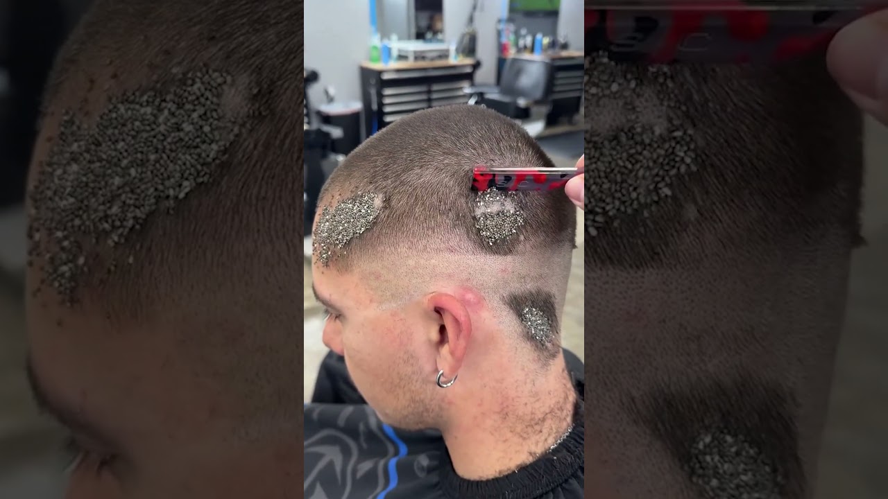 Ce Coiffeur doit Sauver son Client des Poux !✂️